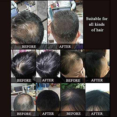 LORELTY Saç İnceltme için Saç Yapı Elyafı Siyah Renk Doğal Bitki ve Hasar Yok Erkekler ve Kadınlar için 10 Saniyede Saç Dökülmesini
